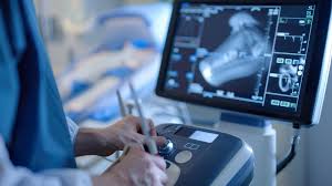 2D Echo Ultrasound